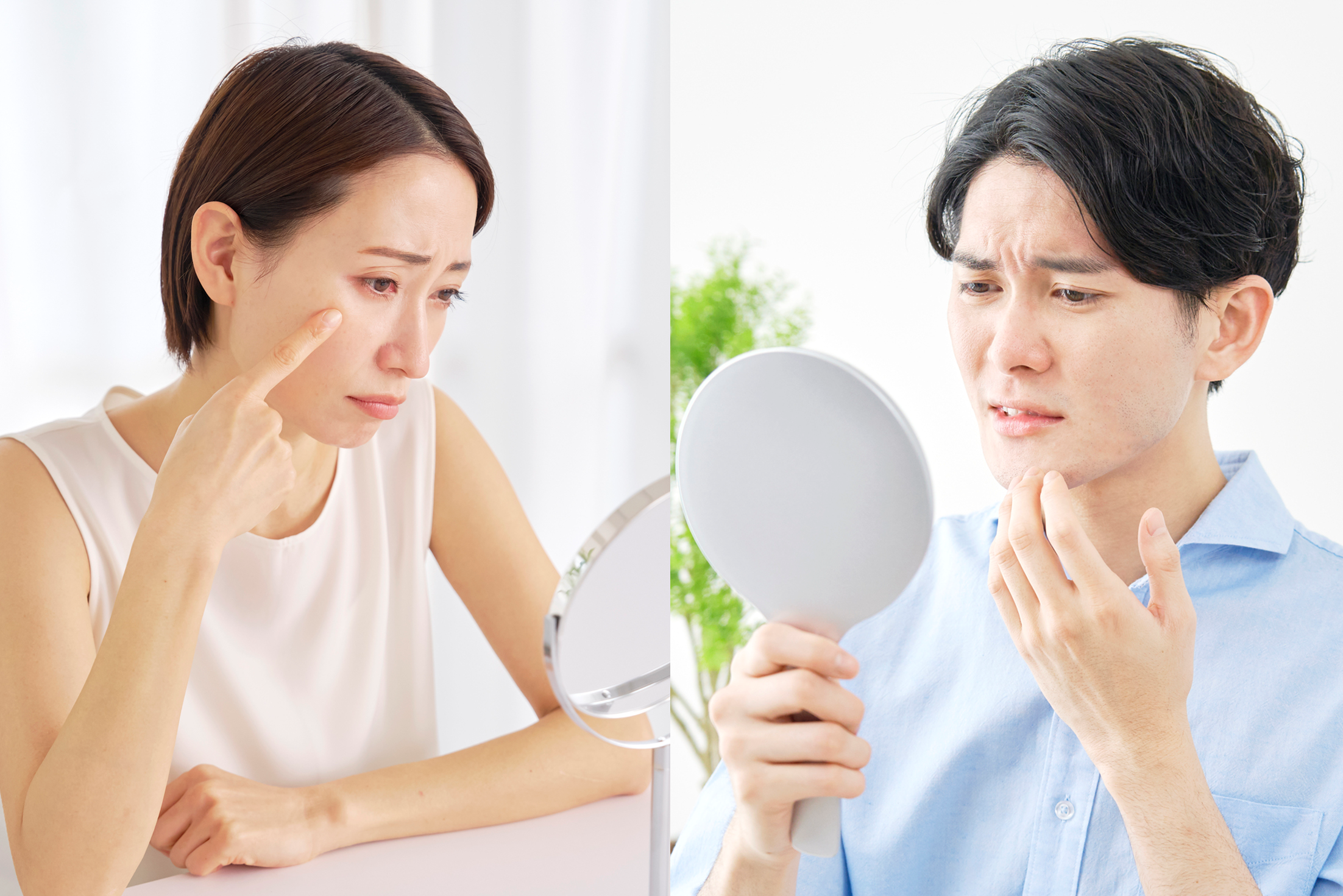 肌荒れの原因とは？30代以降に増えやすい理由とスキンケア・対策