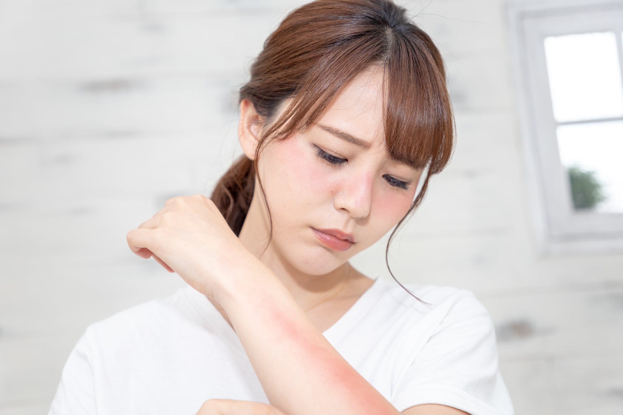 夏の皮膚炎・皮膚トラブルは、正しいケアで早めに対処