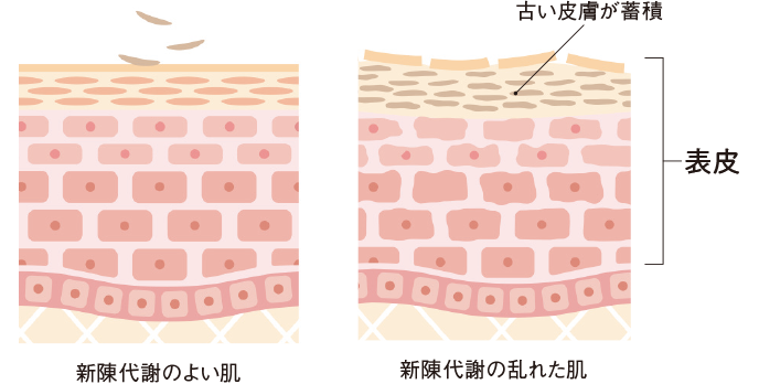 肌断面図