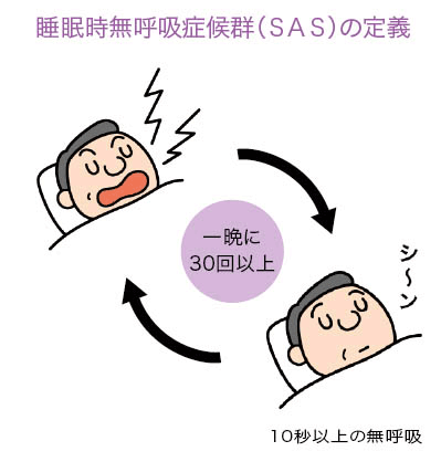 睡眠時無呼吸症候群の定義と重症度