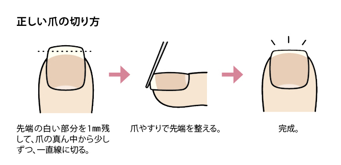 正しい爪の切り方