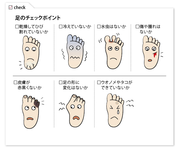 足トラブルのチェック項目