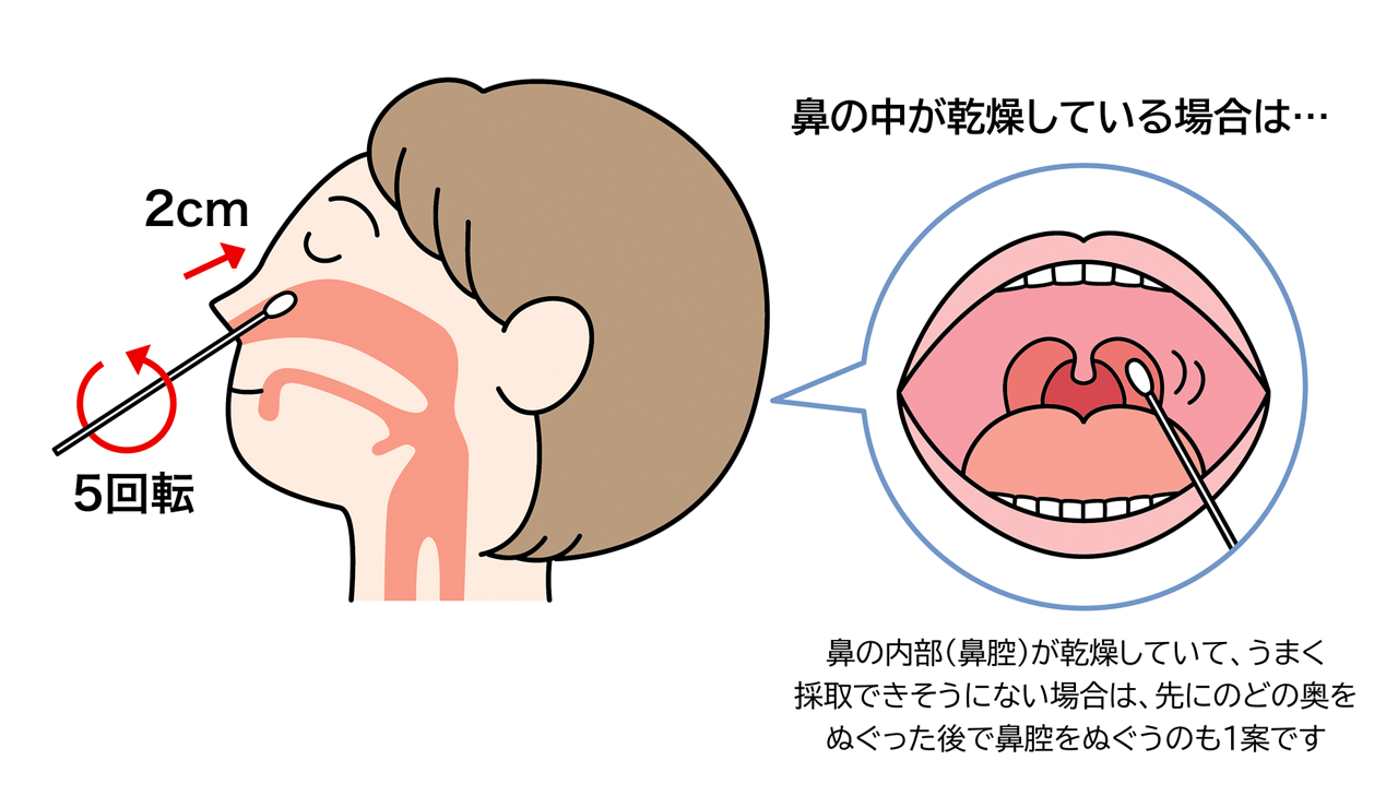 鼻の中が乾燥している場合は先にのどをぬぐうのも1案