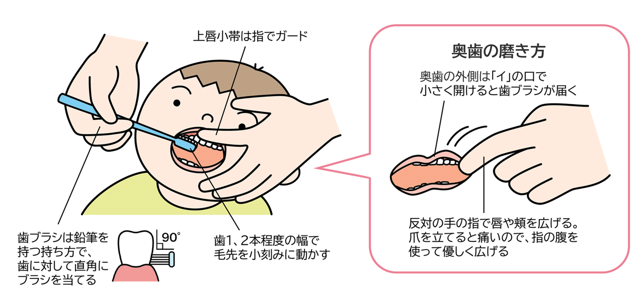 歯ブラシはペンのように持ち、歯に対して直角にブラシを当てる。力を入れずに、歯1、2本程度の幅で毛先を小刻みに動かす●痛みを感じないように、指の腹を使って上唇小帯をガード●奥歯の外側は「イ」の口で、口を小さく開けて磨く。反対側の手で唇や頬を広げる。爪を立てると痛いので、指の腹を使って優しく広げる。