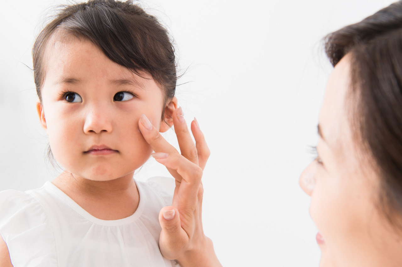 汗が皮膚トラブルにつながる場合もあります