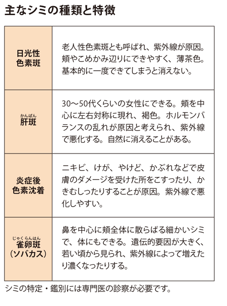 主なシミの種類と特徴