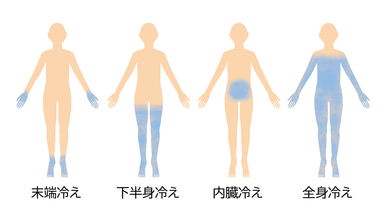 「末端冷え」「下半身冷え」「内臓冷え」「全身冷え」の4つのタイプの冷えのイメージイラスト