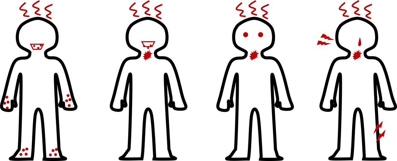 手足口病の主な症状（主に手・足・口腔内の発疹、発熱）、ヘルパンギーナの主な症状（口腔内の発疹、突然の発熱、のどの痛み ）、アデノウイルスの主な症状（結膜炎、発熱、のどの痛み）、新型コロナウイルス感染症の主な症状（発熱、のどの痛み、鼻水、せき、頭痛、倦怠感など）