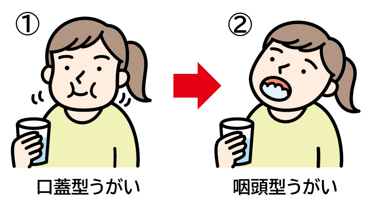 うがいは、口蓋型うがい（ブクブクうがい）の後、咽頭型うがい（ガラガラうがい）を行う。