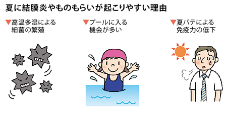 夏に結膜炎やものもらいが起こりやすい理由