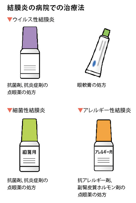 結膜炎の病院での治療法