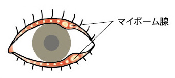 結膜炎・ものもらいリスクチェック