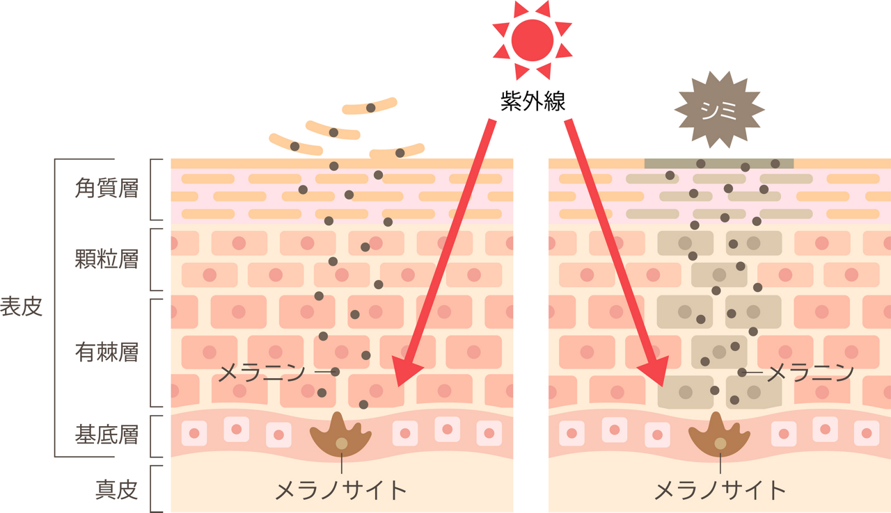 メラニンとターンオーバーの仕組みについてイメージイラスト