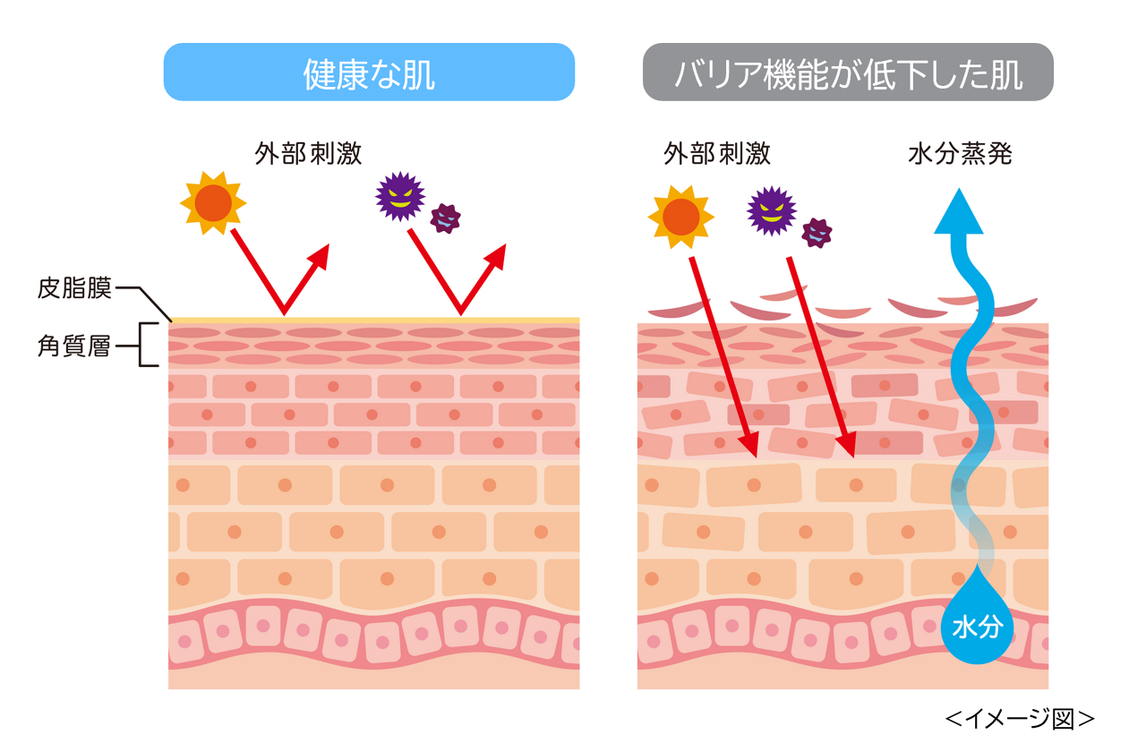 健康的な肌とバリア機能が低下した肌のイメージ画像