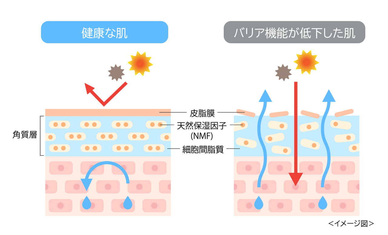 健康的な肌とバリア機能が低下した肌の比較。肌を守る3つの保湿成分「皮脂膜」「天然保湿因子」「細胞間脂質」についてのイメージ画像