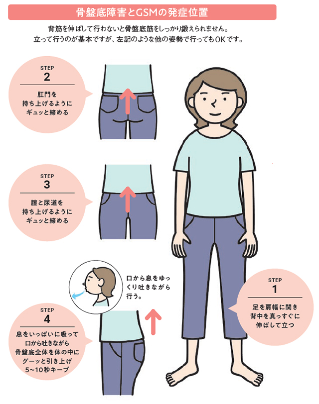 骨盤底障害とGSMの発症位置