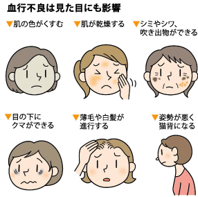 血行不良は見た目にも影響