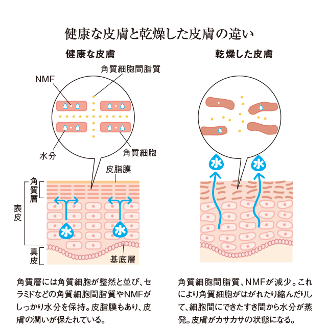 健康な皮膚と乾燥した皮膚の違い