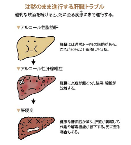 沈黙のまま進行する肝臓トラブル