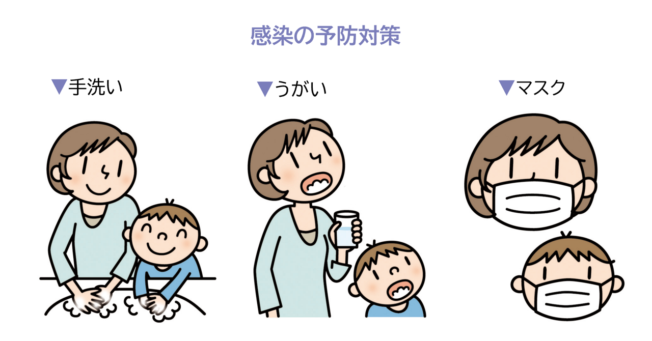 百日咳の感染予防対策は、手洗い、うがい、マスク。