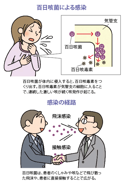 百日咳の感染