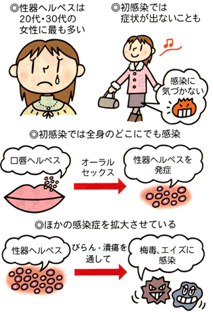 口唇ヘルペス 正しい知識で早めにケア 口唇ヘルペス 正しい知識で早めにケア