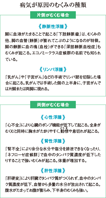 病気が原因のむくみの種類