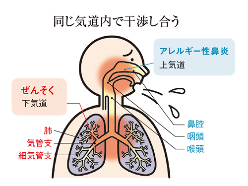 同じ軌道内で干渉し合う