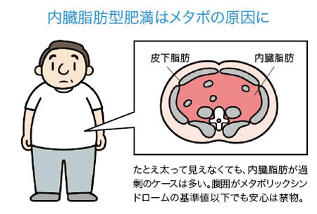 内臓脂肪型肥満はメタボ原因に