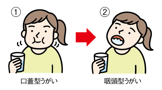 正しいうがいの仕方