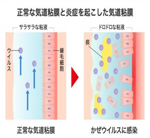 正常な気道粘膜と炎症を起こした気道粘膜