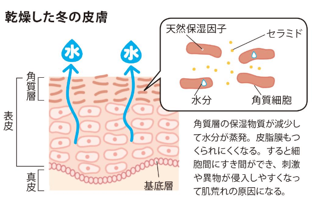 乾燥した冬の皮膚