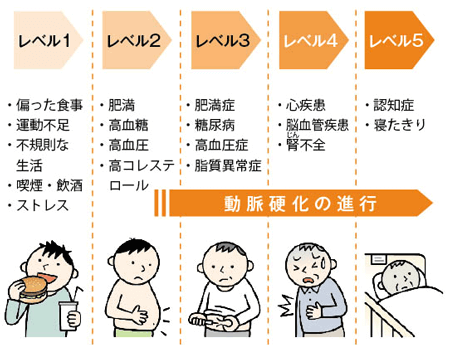 PADの進行を防ぐにはどうすればよいでしょうか?