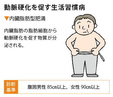 動脈硬化を促す生活習慣病