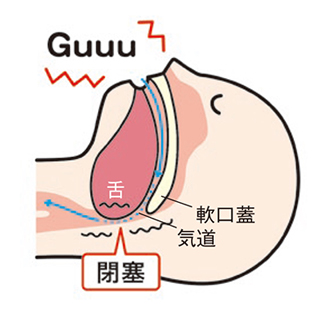 いびきが起こるメカニズム