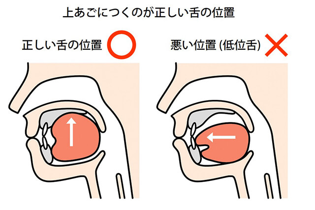 上あごにつくのが正しい下の位置