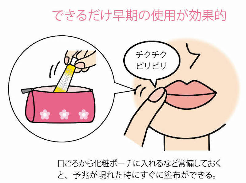 口唇ヘルペス市販薬は、できるだけ早期の使用が効果的