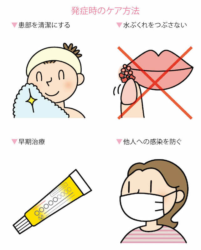 口唇（こうしん）ヘルペスとは？原因 …