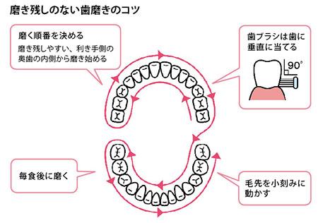 磨き残しのない歯磨きのコツ