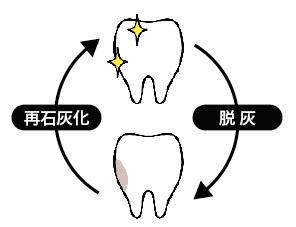 唾液に含まれるカルシウムやリン酸は、日常的に歯の表面のエナメル質を修復し、脱灰による虫歯の進行を防いでいます（再石灰化作用）