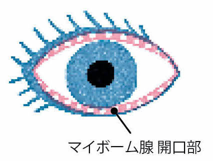 目の縁にある脂質を出す穴「マイボーム腺（せん）」の開口部