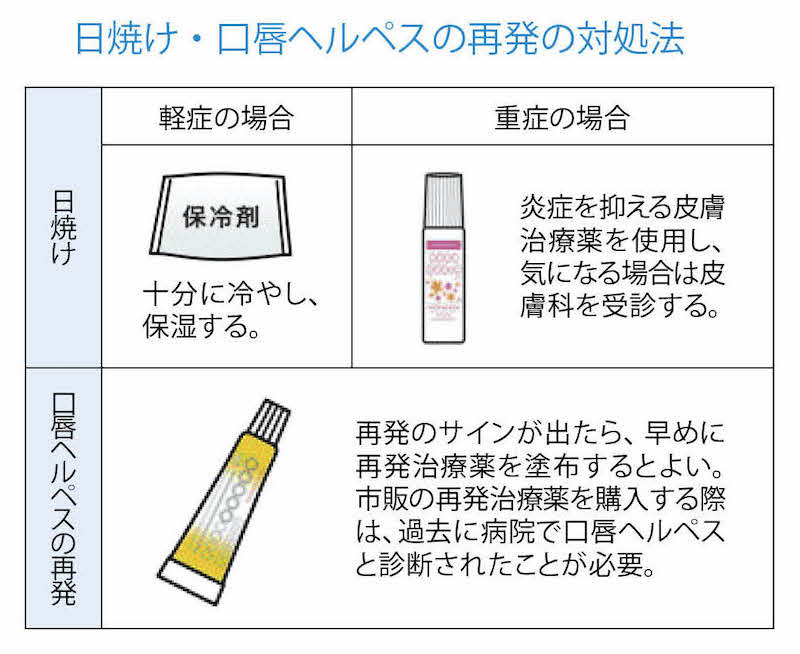 日焼け・口唇ヘルペス再発の対処法。日焼け軽症の場合は十分に冷やし保湿、重症の場合は皮膚治療薬を使用。口唇ヘルペス再発の場合は再発治療薬を塗布。