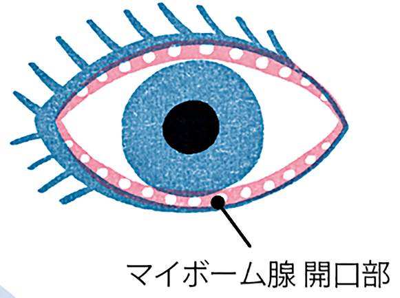 マイボーム腺　開口部