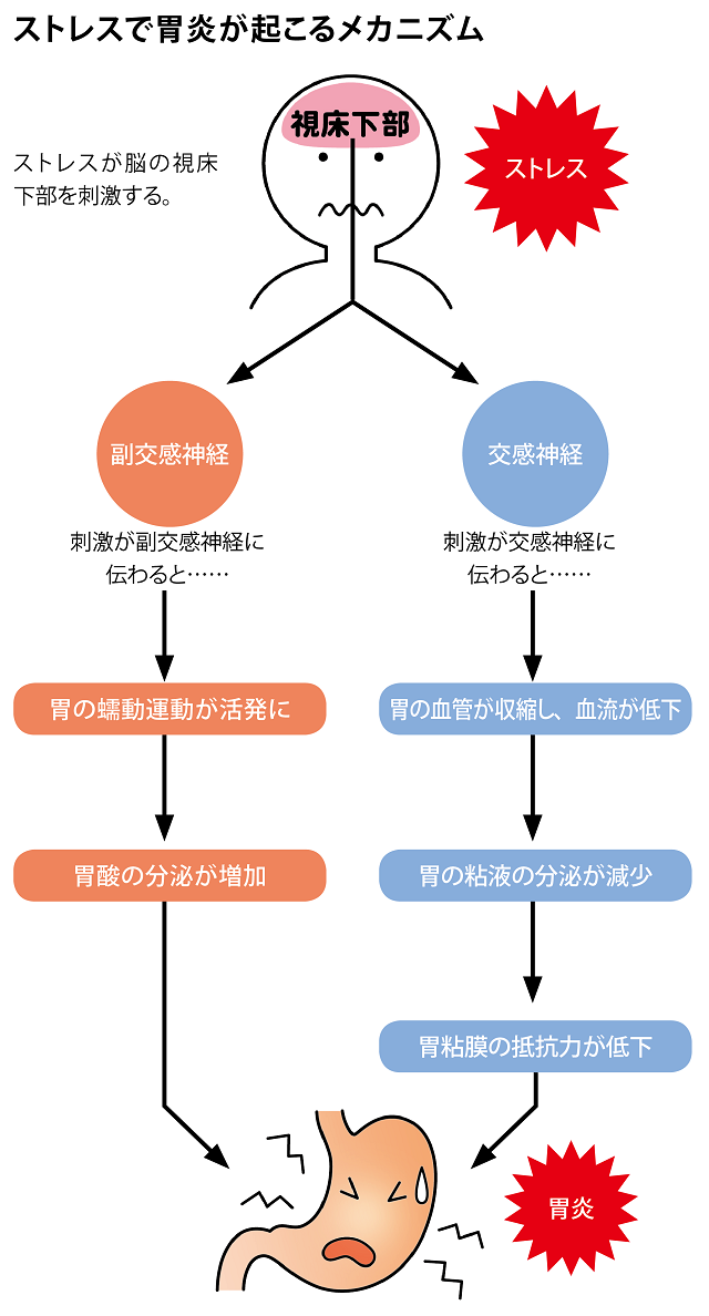 ストレスで胃腸が起こるメカニズム