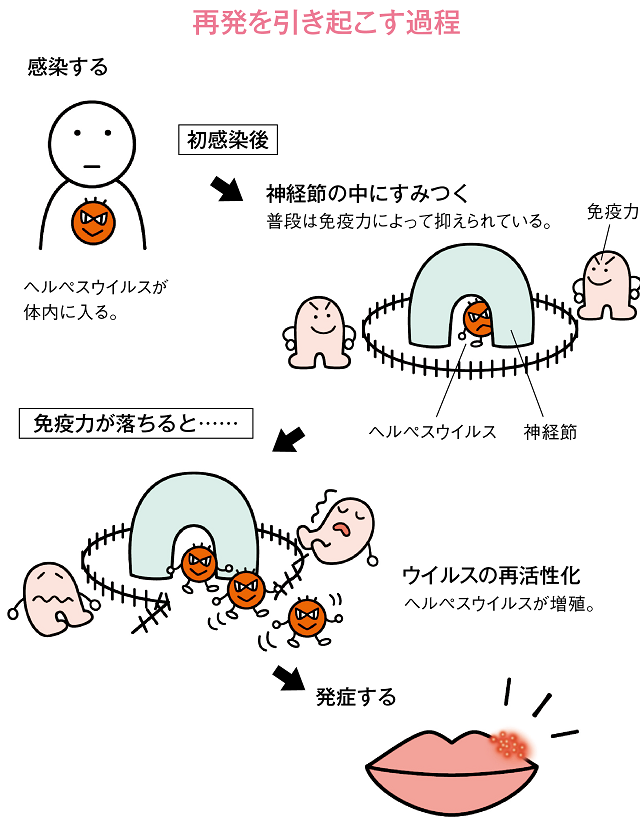 再発を引き起こす過程