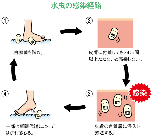 水虫の感染経路