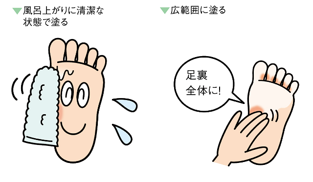 水虫用市販薬の使用ポイント