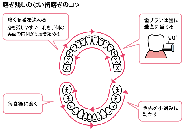 磨き残しのない歯磨きのコツ