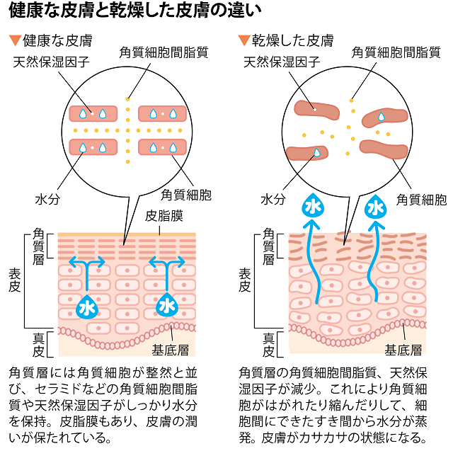 健康な皮膚と乾燥した皮膚の違い