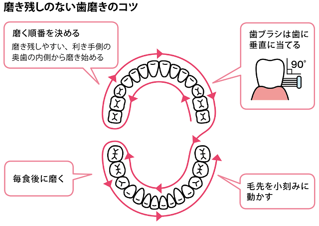 磨き残しのない歯磨きのコツ